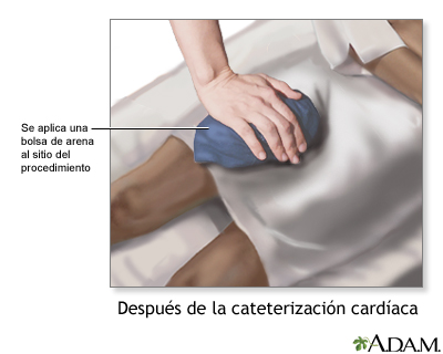 Cuidados postoperatorios (segunda parte)