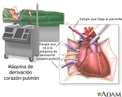 Procedimiento (primera parte)