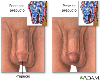 Pene circuncidado y no circuncidado