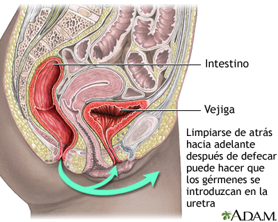 Prevención de la cistitis