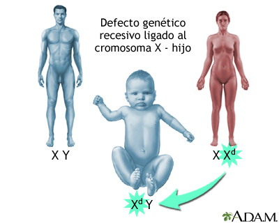 Defectos genéticos recesivos ligados al X - Cómo se ven afectados los niños