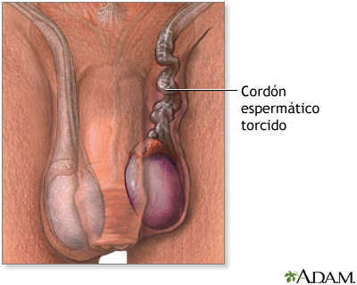 Indicaciones