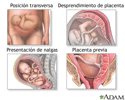 Indicaciones