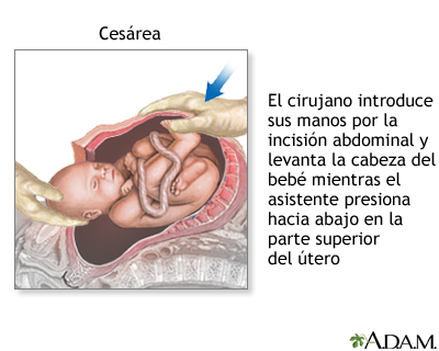 Procedimiento (quinta parte)