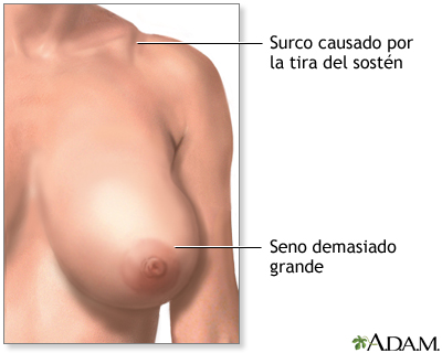 Indicaciones