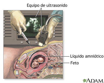 Procedimiento (primera parte)