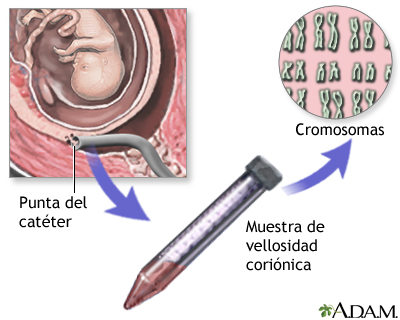 Resultados