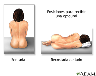 Procedimiento (segunda parte)