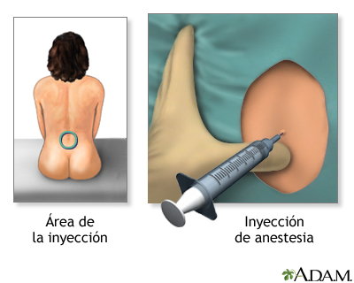 Procedimiento (tercera parte)