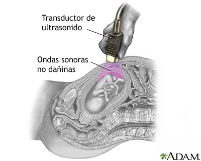 Procedimiento (segunda parte)