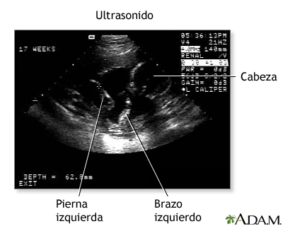 Procedimiento (tercera parte)