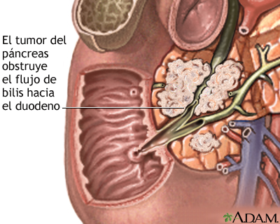 Indicaciones