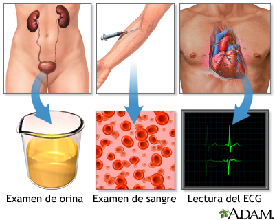 Exámenes de hipertensión