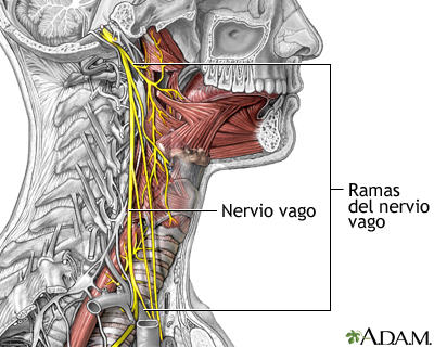 Tratamiento de la epilepsia