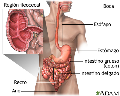 Enfermedad de Crohn; áreas afectadas