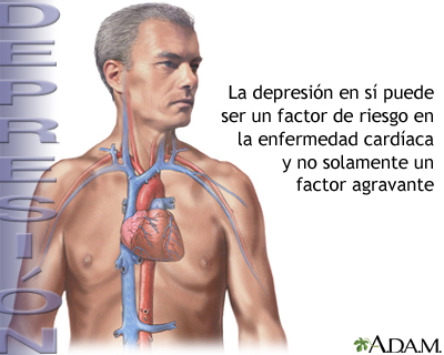 Depresión y enfermedad cardíaca