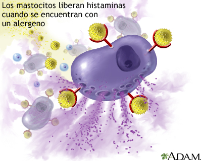 Liberación de histamina