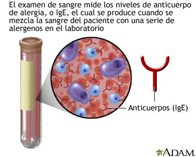 Prueba RAST