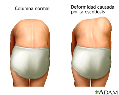 Prueba de inclinación hacia delante