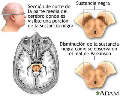 Sustancia negra y el mal de Parkinson