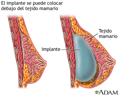 Procedimiento