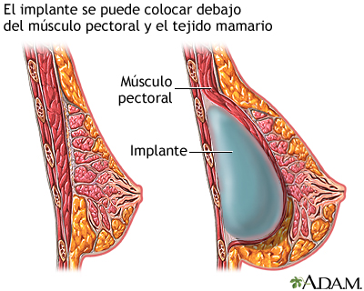 Procedimiento