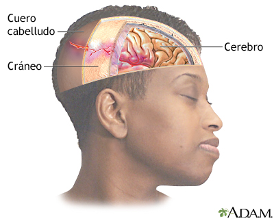 Lesión en la cabeza