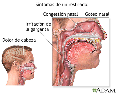 Síntomas del resfriado