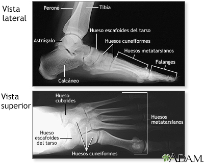 Radiografía del pie normal