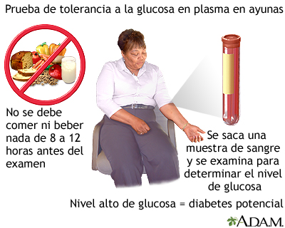 Prueba de tolerancia a la glucosa en ayunas