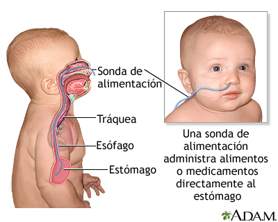 Sonda de alimentación