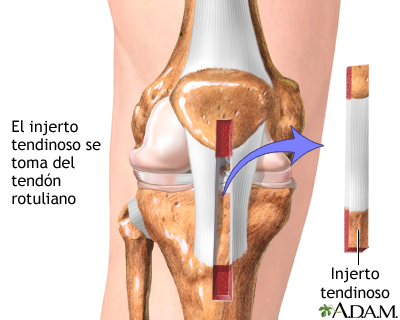 Procedimiento: 1a parte