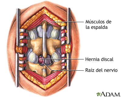 Indicaciones