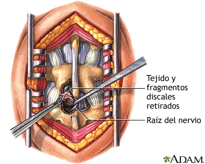 Procedimiento