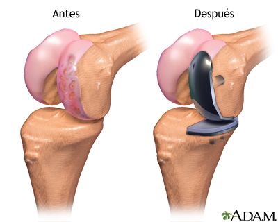 Cuidados postoperatorios