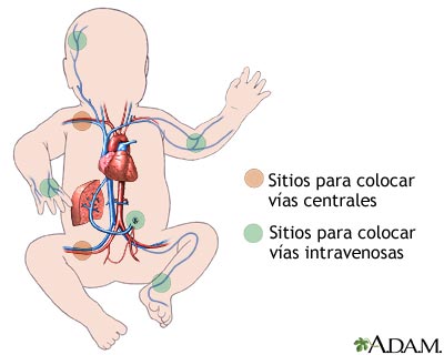 Sitios para administrar líquidos intravenosos