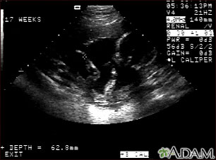 Ultrasonido de un feto normal; brazos y piernas