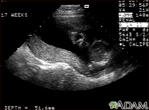 Ultrasonido normal , placenta relajada