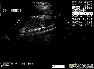 Ultrasonido de un feto normal; columna y costillas