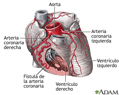 Fístula de la arteria coronaria