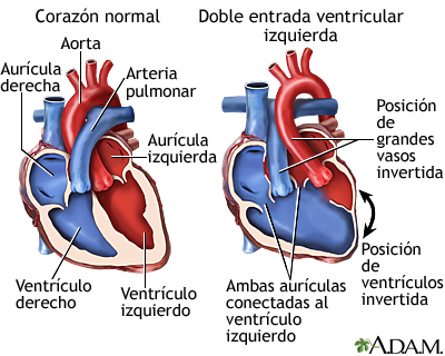 Doble entrada ventricular izquierda