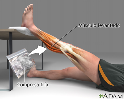 Tratamiento para distensión de la rodilla