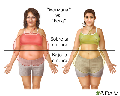 Distintos tipos de aumento de peso