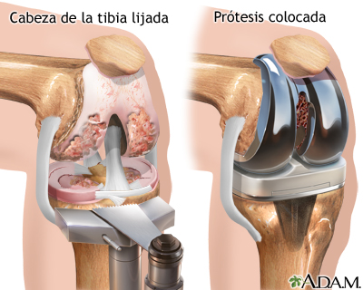 Procedimiento