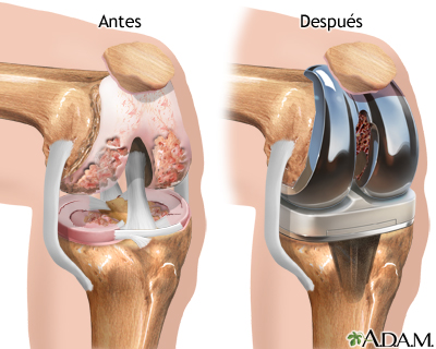 Cuidados postoperatorios