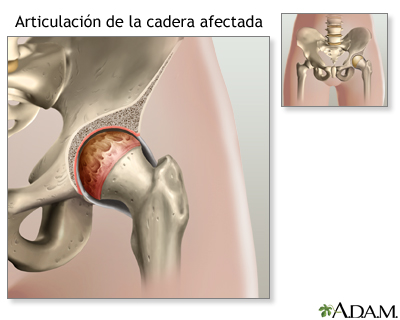 Indicaciones