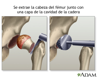 Procedimiento (primera parte)