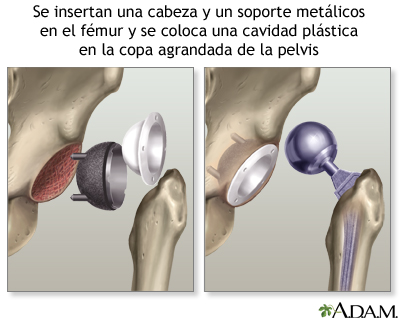 Procedimiento (segunda parte)