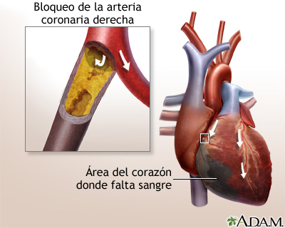 Indicaciones