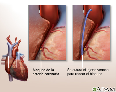 Cuidados postoperatorios